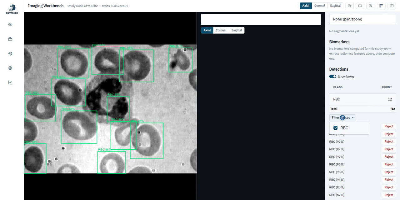 Imaging Workbench blood cell detection with a per-class count panel and filter, twelve red cells found and boxed